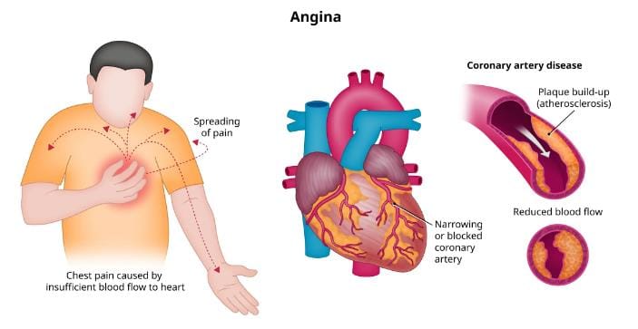 Cardiovascular System - 2 Chapter Notes - Pharmacology - NEET PG PDF ...