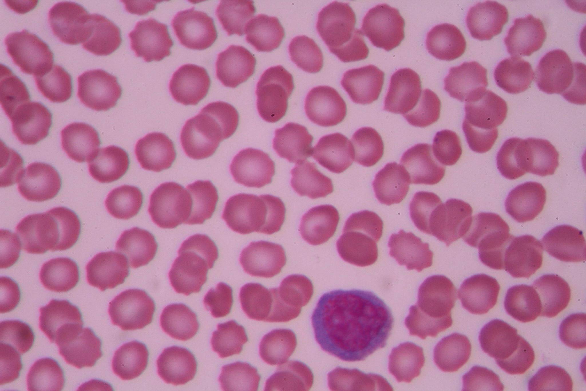 Blood - Notes, Biology | General Awareness - Bank Exams