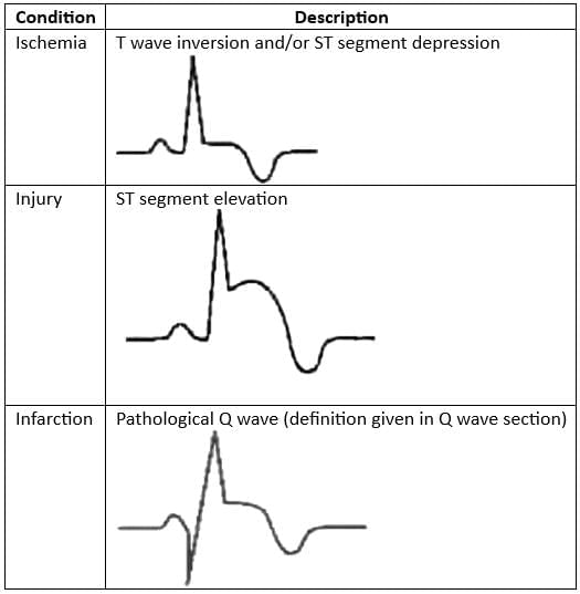 Cardiology Chapter Notes | Medicine - NEET PG