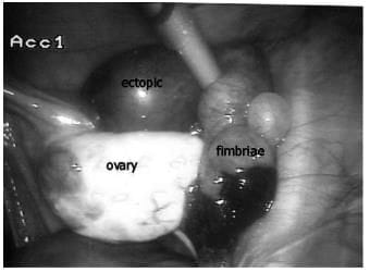 Clinical presentation