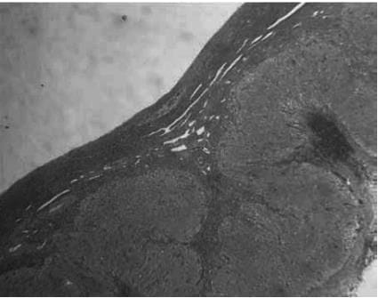 Folliculogenesis and the `Follicular Phase`