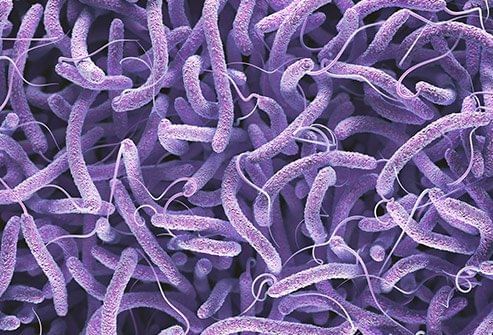 Vibrio cholerae 