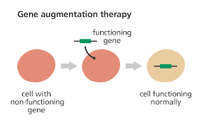 Gene Therapy