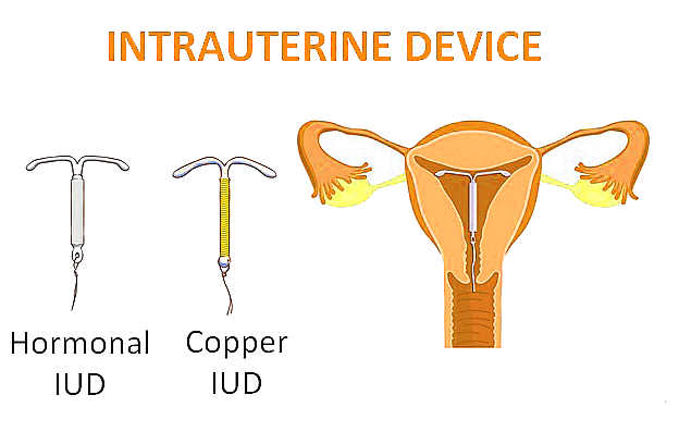 Important Diagrams: Reproductive Health | Biology Class 12 - NEET