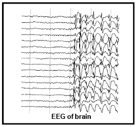 EEG & ECG: Human Health & Diseases | Additional Study Material for NEET