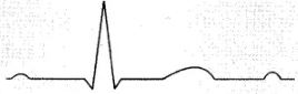 NCERT Exemplars: Body Fluids & Circulation | Biology Class 11 - NEET