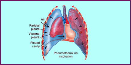 Common Diseases in Humans - 2 | Biology Class 12 - NEET