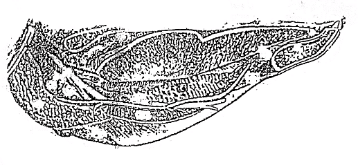 Fig: Left Submaxillary and Sublingual Glands, and Mandibular Duct