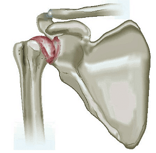 Shoulder Joint | Medical Science Optional Notes for UPSC