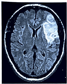 Magnetic Resonance Imaging (MRI) | Medical Science Optional Notes for UPSC