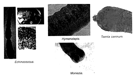 Platyhelminthes: Taenia Solium | Zoology Optional Notes for UPSC