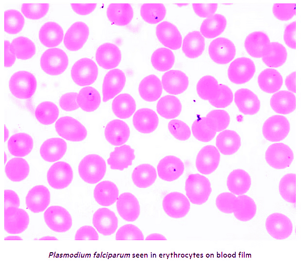 Malaria | Zoology Optional Notes for UPSC