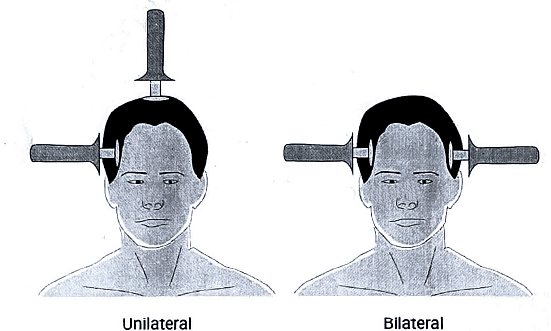The Mental Healthcare Act 2017, Electroconvulsive Ttherapy | Medical Science Optional Notes for UPSC