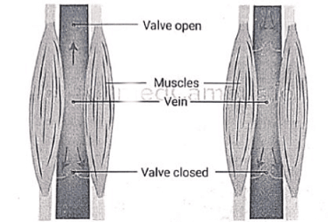 Varicose Veins | Medical Science Optional Notes for UPSC