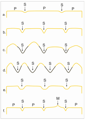 Basic Concepts of Geomorphology | Geology Optional for UPSC