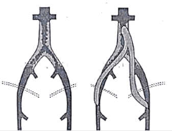 Peripheral Arterial Disorders | Medical Science Optional Notes for UPSC