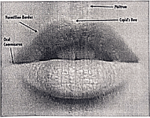 Oral Cancer | Medical Science Optional Notes for UPSC