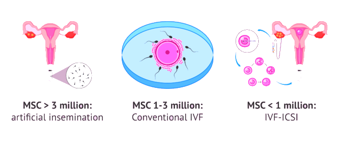 Sperm Cell Capacitation | Zoology Optional Notes for UPSC