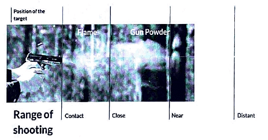 Firearm Entry vs Exit wound | Medical Science Optional Notes for UPSC