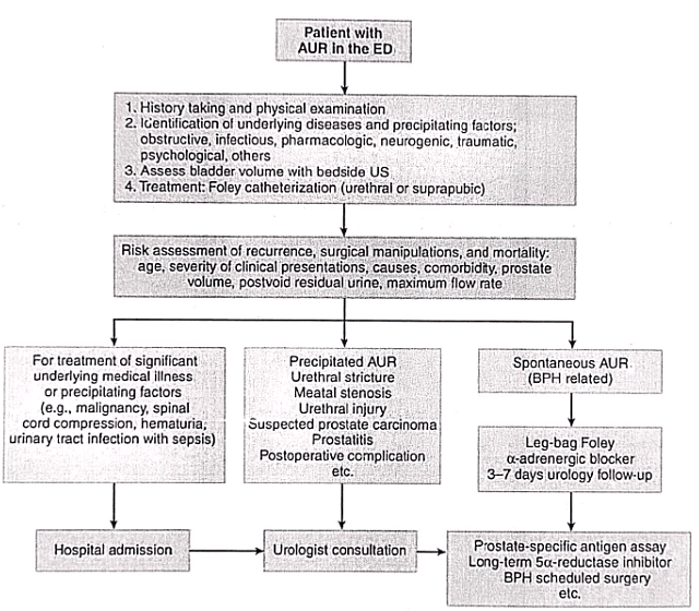 Prostate Neoplasms | Medical Science Optional Notes for UPSC
