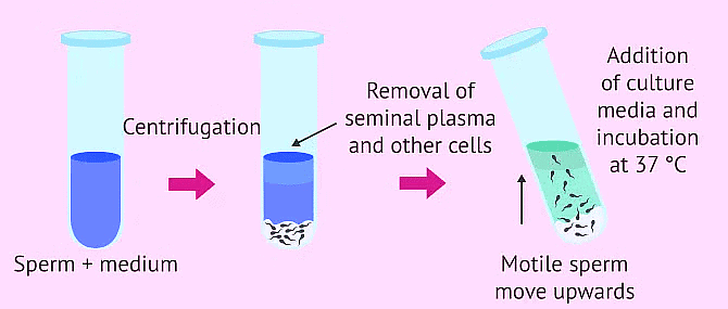 Sperm Cell Capacitation | Zoology Optional Notes for UPSC