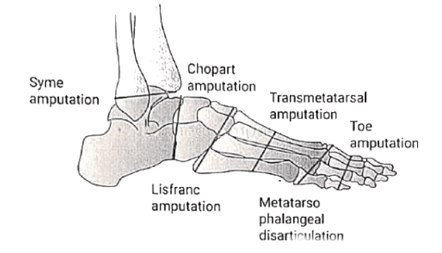 Peripheral Arterial Disorders | Medical Science Optional Notes for UPSC