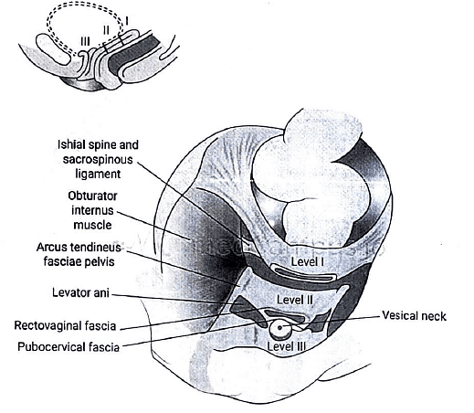 Prolapse of uterus | Medical Science Optional Notes for UPSC