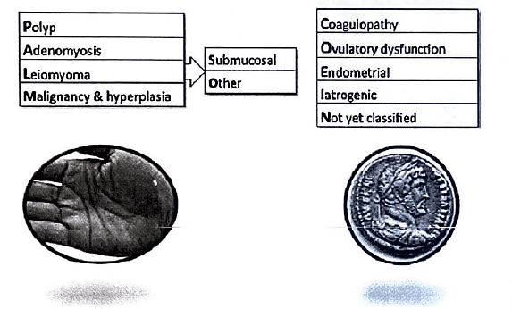 Menstrual Disorders | Medical Science Optional Notes for UPSC