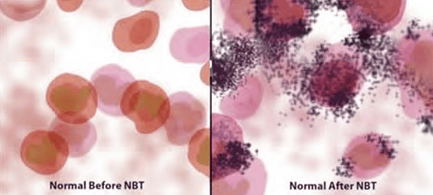 Assessment of Immune Function, Monoclonal Antibodies | Medical Science Optional Notes for UPSC