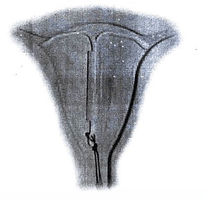 Contraception | Medical Science Optional Notes for UPSC