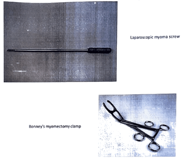 Uterine Fibroid | Medical Science Optional Notes for UPSC
