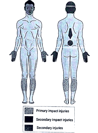 Pedestrian Injuries - Medical Science Optional Notes for UPSC PDF Download