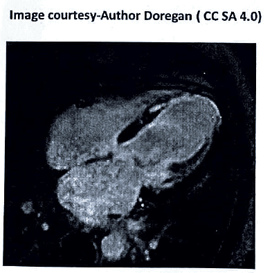 Magnetic Resonance Imaging (MRI) | Medical Science Optional Notes for UPSC