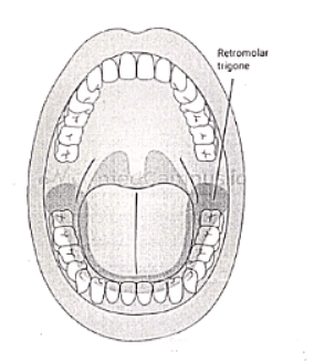 Oral Cancer | Medical Science Optional Notes for UPSC