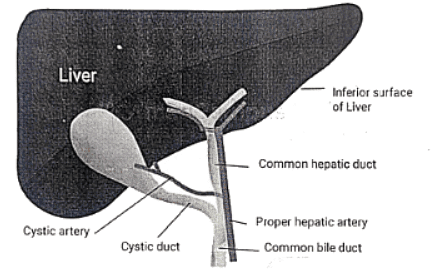 Gall Stones | Medical Science Optional Notes for UPSC
