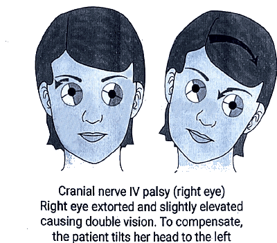 Descending Pathways: Neuroanatomy | Medical Science Optional Notes for UPSC