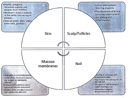 Lichen Planus | Medical Science Optional Notes for UPSC