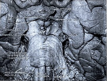Descending Pathways: Neuroanatomy | Medical Science Optional Notes for UPSC