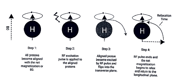 Magnetic Resonance Imaging (MRI) | Medical Science Optional Notes for UPSC