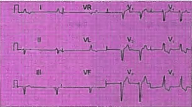 Cardiology Chapter Notes | Medicine - NEET PG