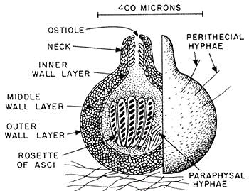 Perithecium
