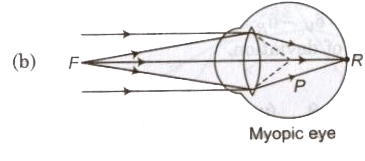 Optical Instruments | Physics Class 12 - NEET