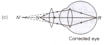 Optical Instruments | Physics Class 12 - NEET