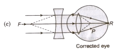Optical Instruments | Physics Class 12 - NEET