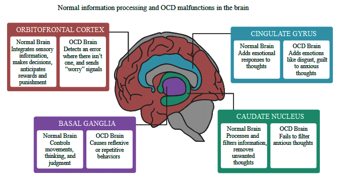 What is obsessive compulsive disorder (OCD)? | Psychology and Sociology for MCAT