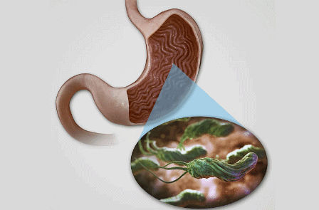 Helicobacter pylori are microaerophilic bacteria found in the stomach. They are neutrophiles that secrete an enzyme that neutralizes stomach acid.