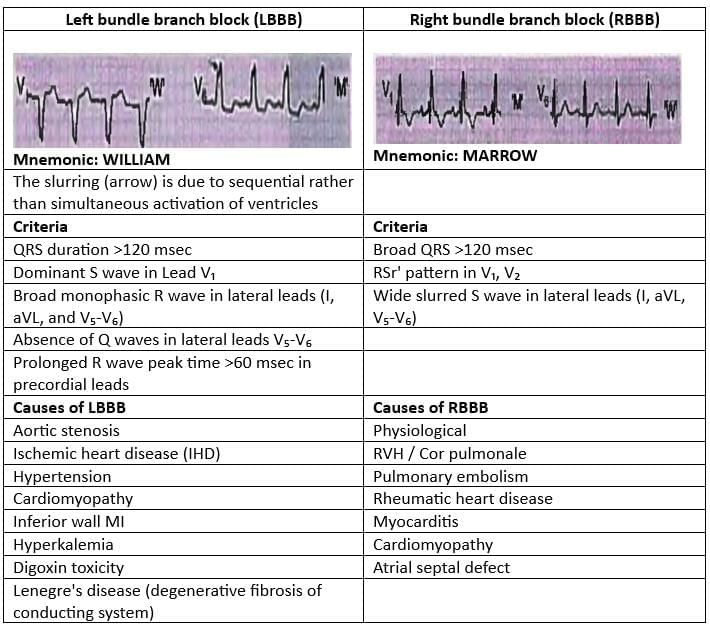 Cardiology Chapter Notes | Medicine - NEET PG