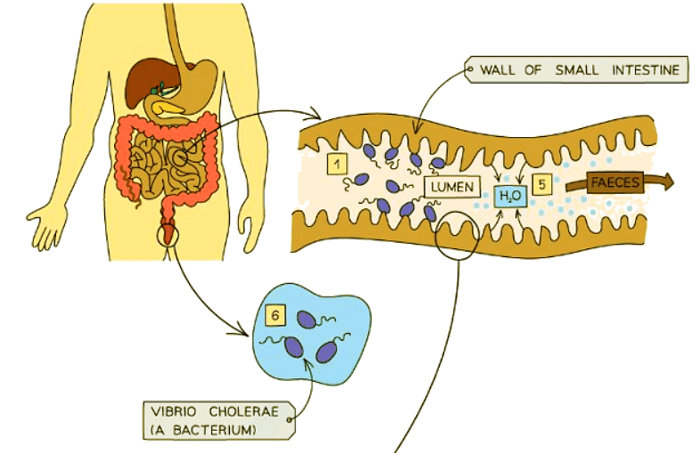 Cholera | Biology for GCSE/IGCSE - Class 10