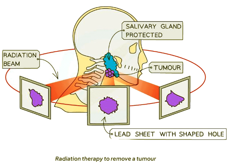 Uses of Radiation | Physics for GCSE/IGCSE - Year 11