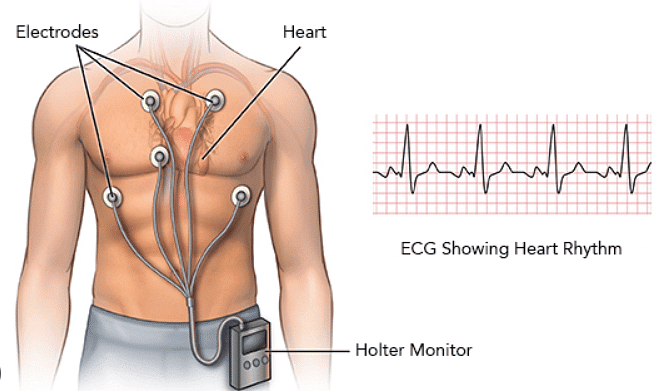 Monitoring Activity of the Heart | Biology for GCSE/IGCSE - Year 11